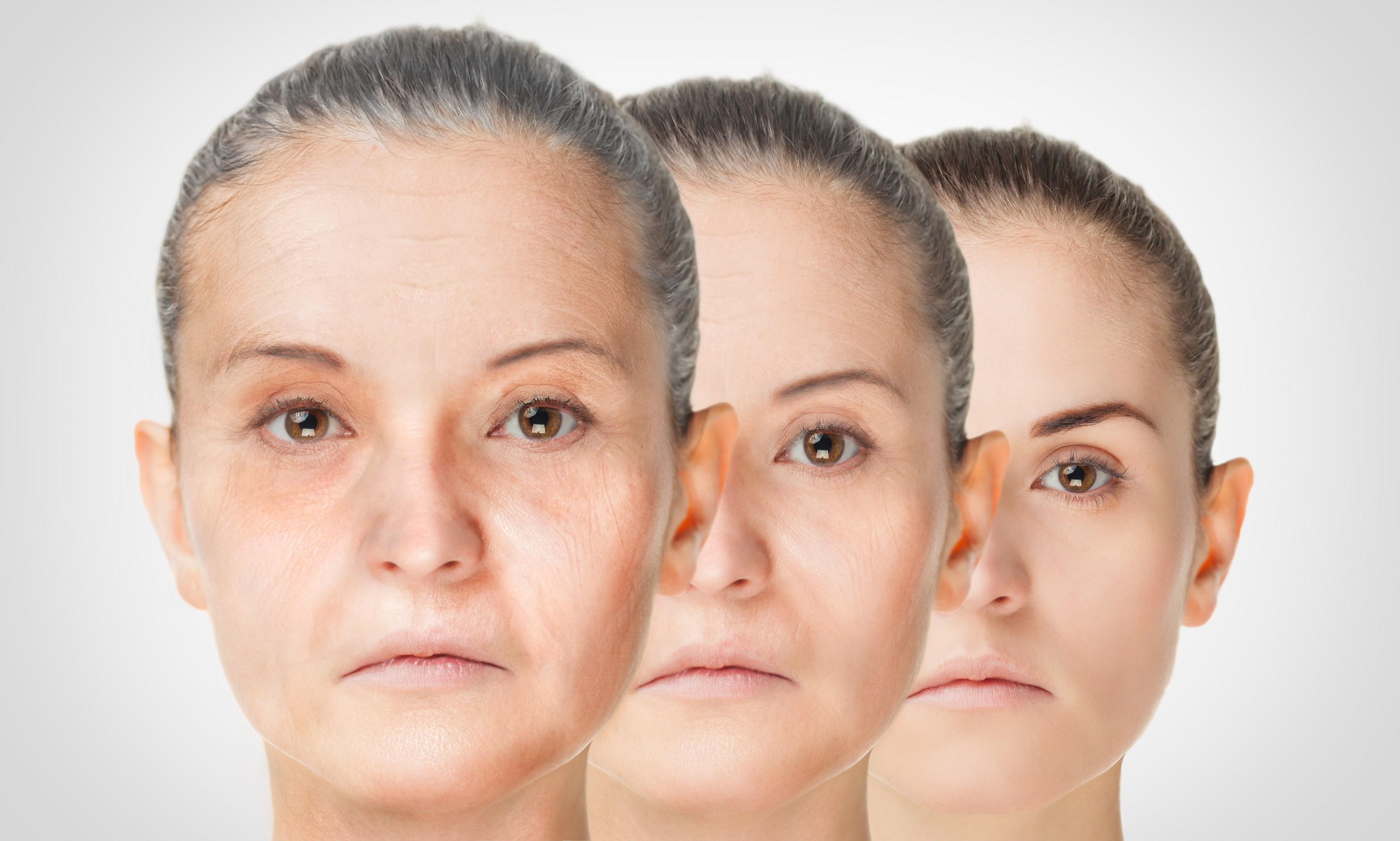 Aging process, rejuvenation anti-aging skin procedures